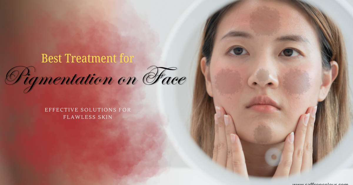 Best Treatment for Pigmentation on Face: Effective Solutions for Flawless Skin