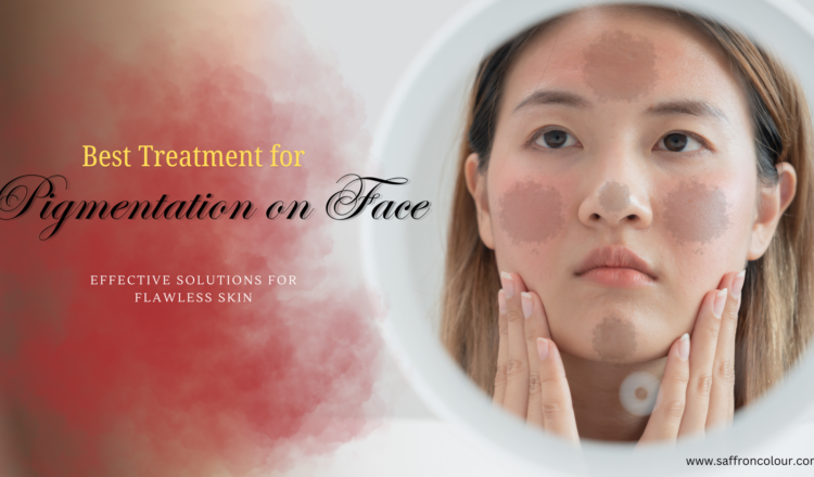 Best Treatment for Pigmentation on Face: Effective Solutions for Flawless Skin